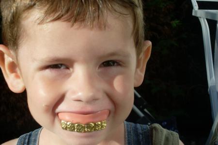 belle dents